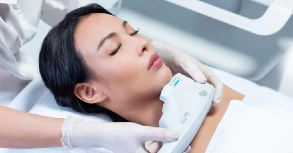 harga perawatan ultherapy